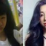 Jalani Operasi Plastik karena Putus dengan Pacar, Gadis Ini Jadi Viral
