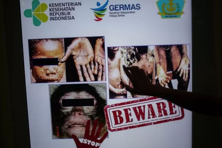 Sebuah iklan kesehatan masyarakat mengenai cacar monyet dipasang di Bandara Soekarno-Hatta, Tangerang, Mei 2019.