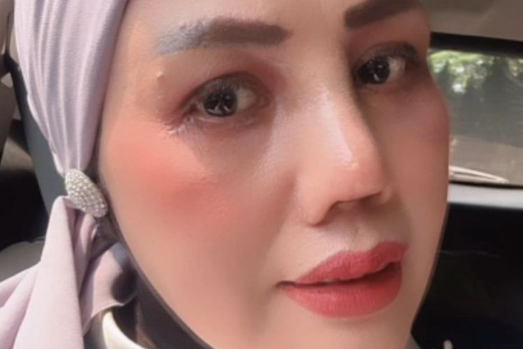 Tetap Operasi Plastik Meski Ditentang Anak, Elly Sugigi: Dia Masih Butuh Uang Aku