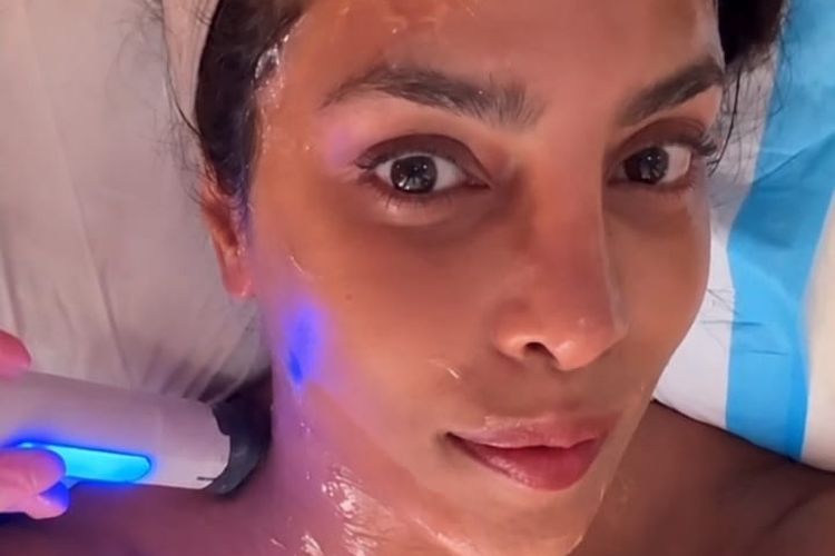 Aktris Priyanka Chopra membagikan treatment pengencangan wajah yang dilakukannya di akun instagramnya.