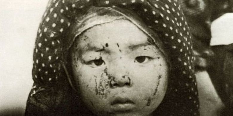 Kisah Perang Derita Tiada Tara Hibakusha Penyintas Bom Atom Hiroshima Nagasaki Halaman All Kompas Com
