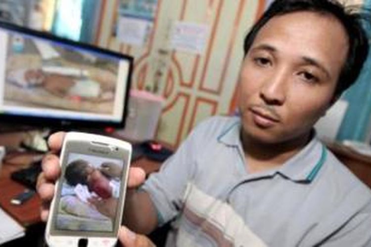 Fadly (30) memperlihatkan luka terpanggang bayinya akibat inkubator di Perintis Kemerdekaan 4, Makassar, Senin (27/10/2014). Bayi yang lahir prematur pada hari selasa 21 Oktober 2014 di Rumah Sakit Bersalin Bunda meninggal akibat terpanggang di dalam inkubator yang disebabkan kelalaian petugas rumah sakit tersebut. 