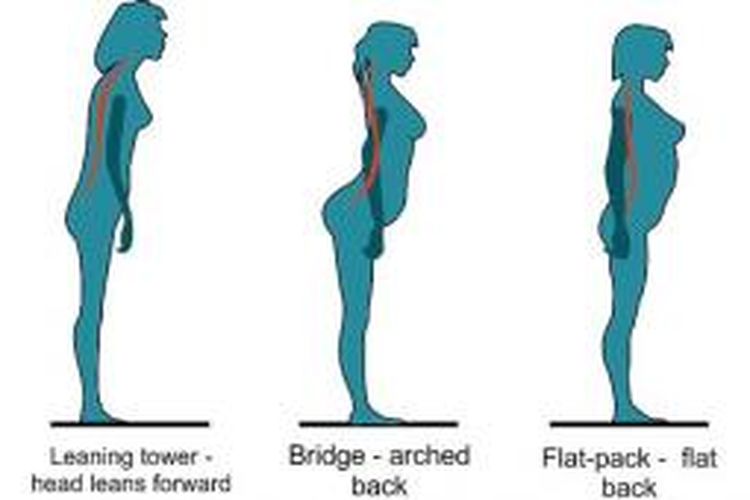 Tipe postur tubuh