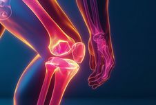 Resolusi Sehat dengan Bermain Golf di 2026, Waspadai Nyeri yang Berpotensi Cedera