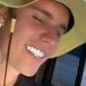Justin Bieber Pamerkan Gigi Berlian Custom di Instagram