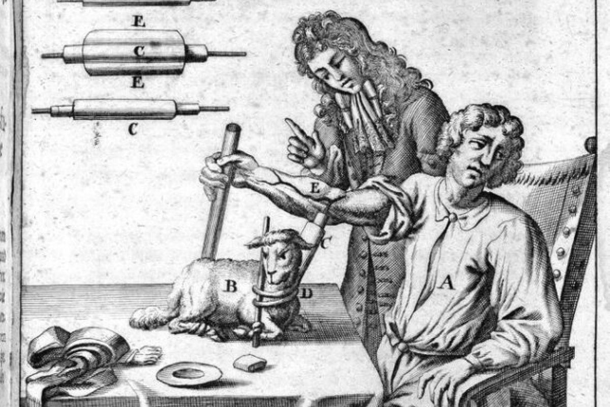 Ilustrasi tranfusi susu, salah satu bentuk pengobatan medis paling aneh yang pernah tercatat dalam sejarah manusia.