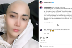 Penampilan Aida Saskia Kini Setelah Divonis Kanker Payudara Stadium 3