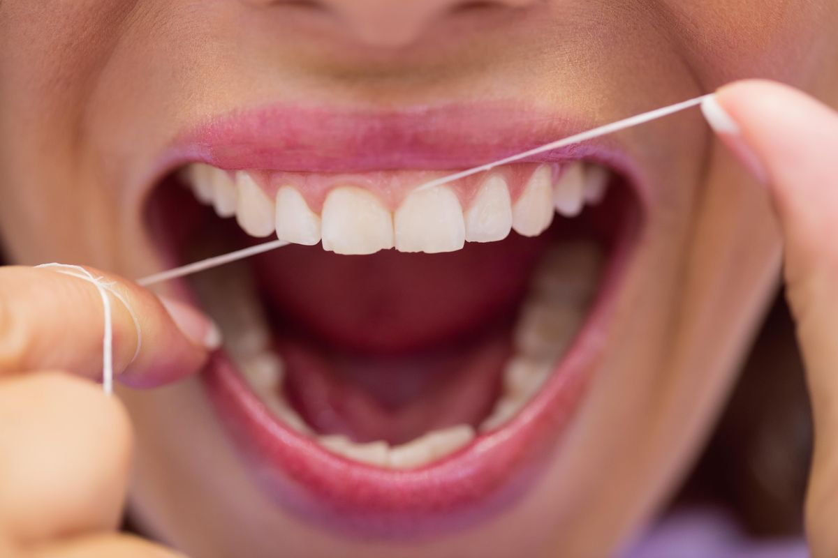 Ilustrasi dental flossing untuk mencegah karang gigi