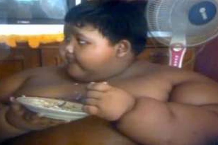 Arya Permana, bocah berusia 10 tahun asal Cipurwasari, Karawang, Jawa Barat, memiliki berat hingga 140 kilogram.