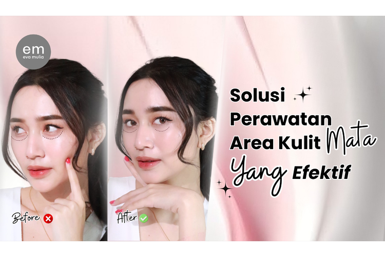 Eva Mulia Clinic menghadirkan solusi inovatif untuk mengatasi berbagai permasalahan kulit area mata lewat Rejuran Eye Treatment.