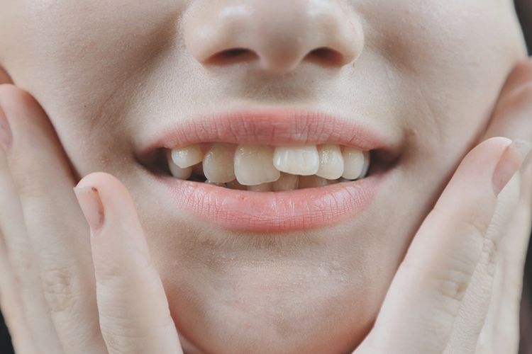 Mengetahui penyebab gigi bengkok sangat penting agar bisa mendapatkan perawatan yang tepat.