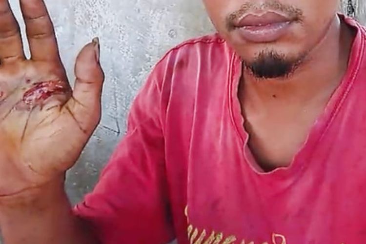 MA (29), warga Desa Baomekot, Kecamatan Hewokloang, Kabupaten Sikka, NTT, dihukum pegang besi panas untuk membuktikan benar atau salah, Sabtu (14/11/2020).