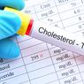 5 Cara Turunkan Kadar Kolesterol Saat Lebaran