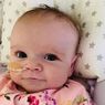 Kisah Erin, Bayi 6 Bulan yang Sakit Jantung dan Berhasil Kalahkan Virus Corona