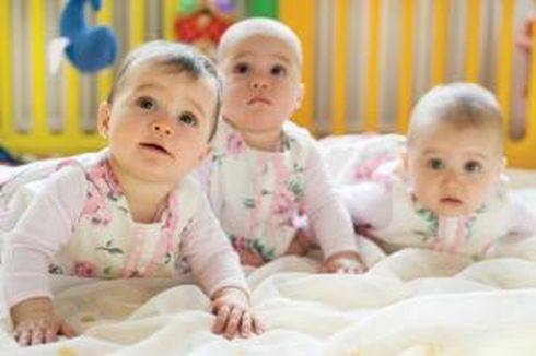 Bayi Kembar Parasit Butuh Spesialis Pediatri Sosial