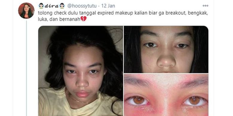 Muka Bengkak Karena Skincare