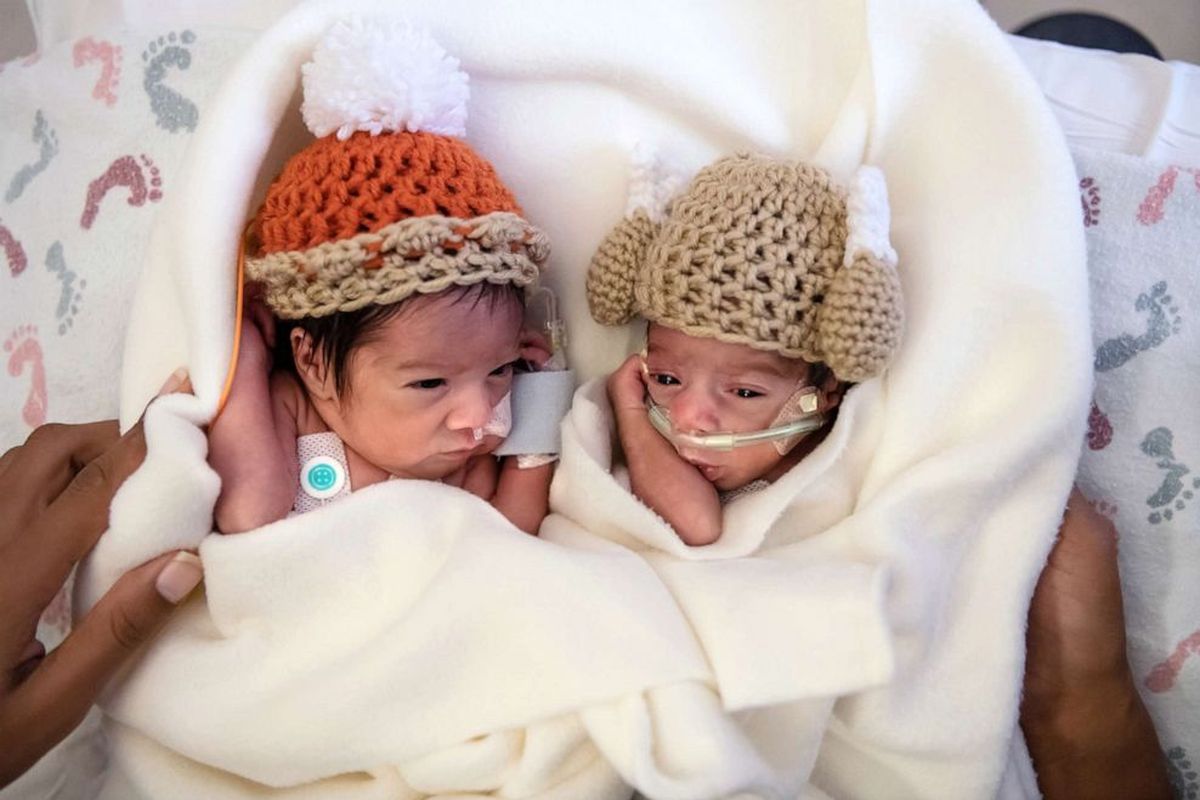 Bayi kembar Camden dan Callie Riley adalah satu dari 12 pasang bayi kembar yang lahir di RS Saint Luke, Kansas City, dalam suasana Thanksgiving. 