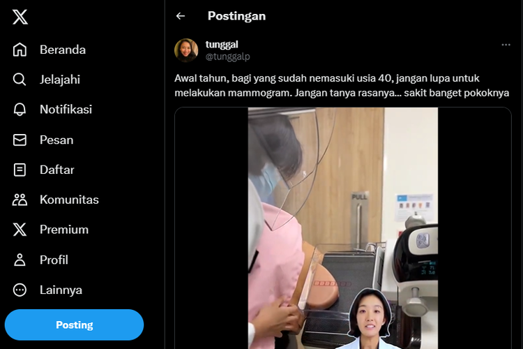 Tangkap layar unggahan video soal tindakan medis mammografi atau mammogram.