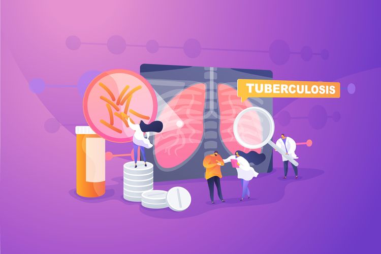 Ilustrasi TBC, tuberculosis