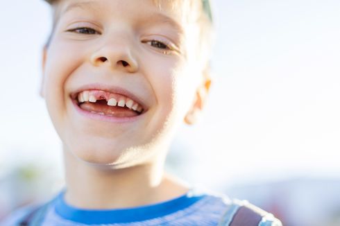 6 Makanan Terburuk untuk Gigi Anak yang Sebaiknya Dihindari