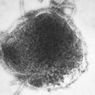 Virus Campak Tak Mudah Bermutasi, Vaksin Beri Daya Lindung 97 Persen