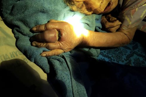 Kisah Nenek 106 Tahun, Jari Membengkak gara-gara 3 Cincin yang Terpasang, Dilepas oleh Damkar
