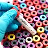 Muncul Hoaks yang Menyebut Vaksin Covid-19 Dapat Menyebabkan Sifilis