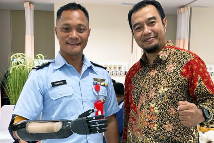 Alat bantu tangan Bionik Undip mendapat apresiasi dari Menteri Pertahanan (Menhan) Prabowo Subianto saat Peresmian Rumah Sakit Pusat Pertahanan Negara (RS PPN) Panglima Besar Soedirman, Pesanggrahan, Jakarta Selatan, Senin (19/2/2024) lalu.