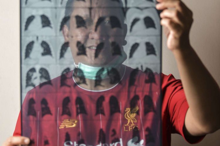 Simon Nainggolan (50) menunjukkan hasil rontgen paru-paru miliknya di Jakarta.