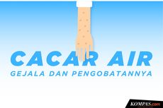 INFOGRAFIK: Mengenal Cacar Air, Gejala dan Pengobatannya