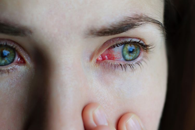 Menghindari kebiasaan menyentuh mata adalah salah satu cara mengatasi mata gatal dan merah.