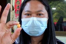 Wanita Ini Temukan Mutiara Oranye Bernilai Miliaran Rupiah di Makan Siangnya
