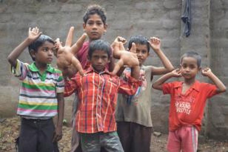 Bandingkan ukuran kedua tangan Kaleem dengan tangan anak-anak lain seusianya.