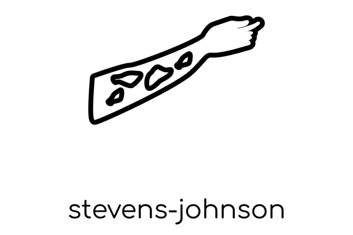 Ilustrasi sindrom stevens-johnson