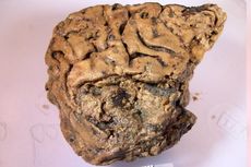 Misteri Otak Berumur 2.600 Tahun yang Masih Utuh, Ahli Temukan Penyebabnya
