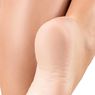 Beberapa Penyebab dan Cara Atasi Kulit Kaki Kering dan Pecah-pecah