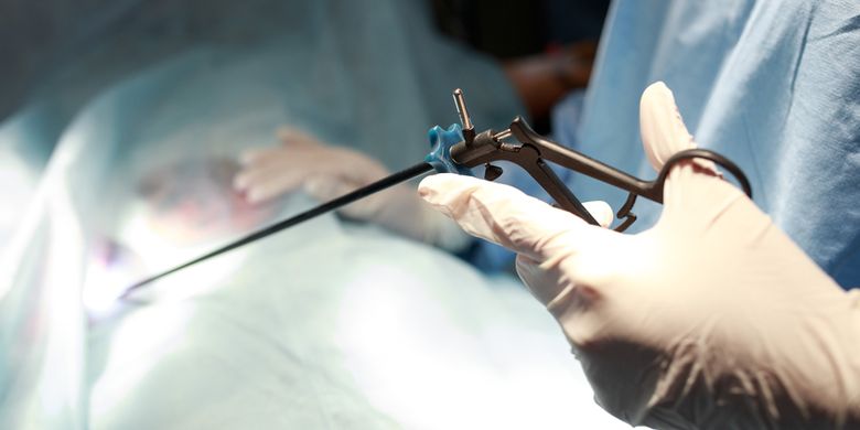 Ilustrasi penanganan usus buntu dilakukan melalui operasi. 