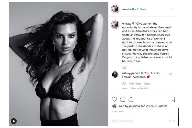 Model Emily Ratajkowski berpose untuk majalah Harpers Bazaar edisi September 2019 dengan memperlihatkan bulu ketiaknya yang lebat.