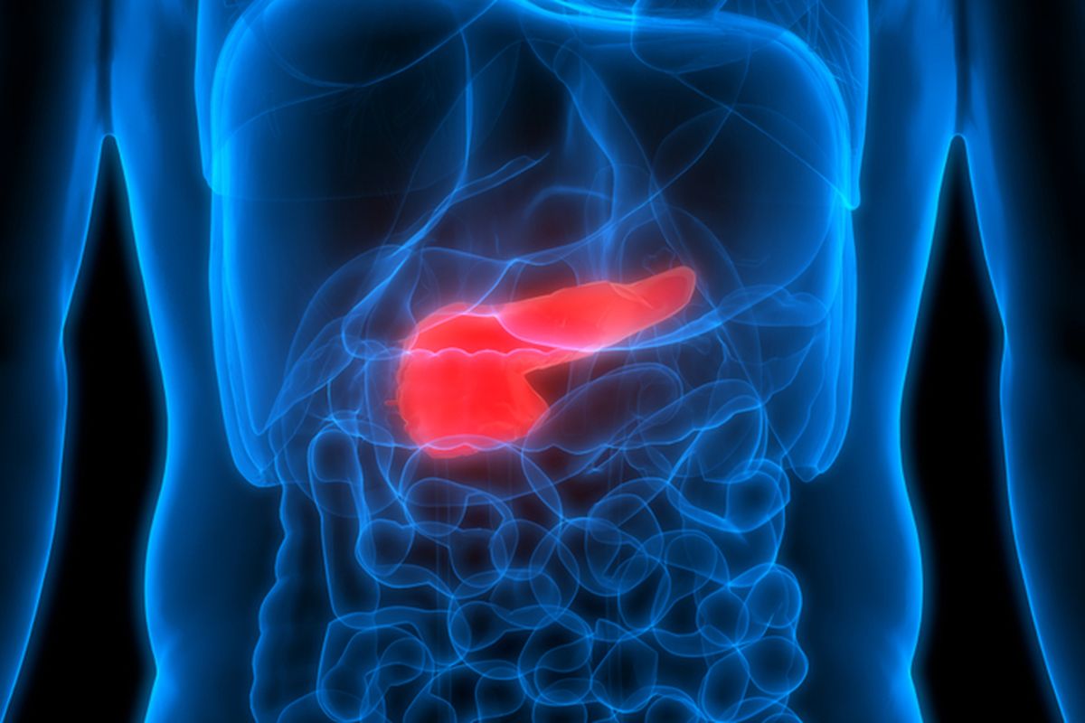 Kanker pankreas tidak menyebabkan gejala di awal. Ketika tumor semakin besar, baru gejala muncul. Karenanya, penyakit ini disebut silent killer.