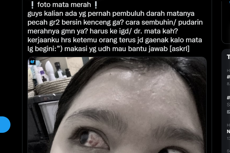 Tangkapan layar twit soal pembuluh darah pecah pada mata akibat bersin kencang.