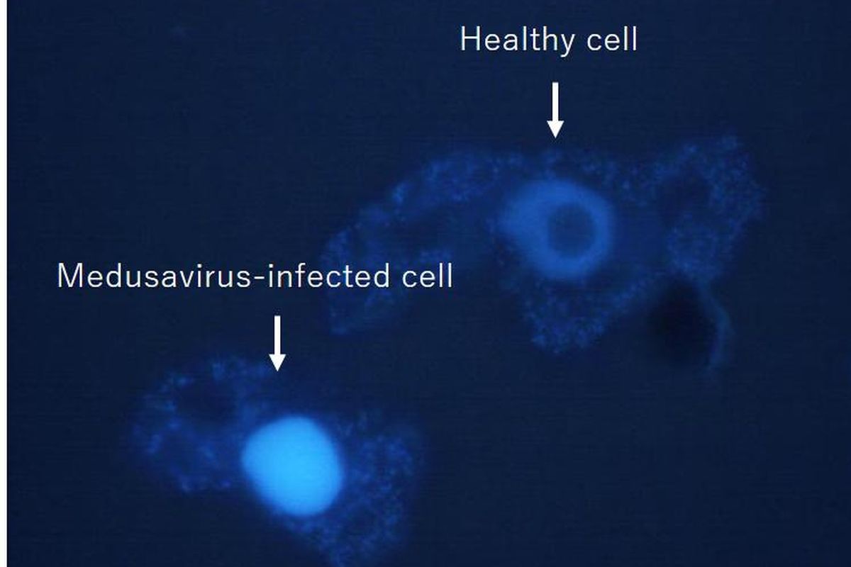 Medusavirus, virus raksasa yang ditemukan ahli virologi Jepang. Studi virus ini dapat menjelaskan asal-usul tentang evolusi sel.