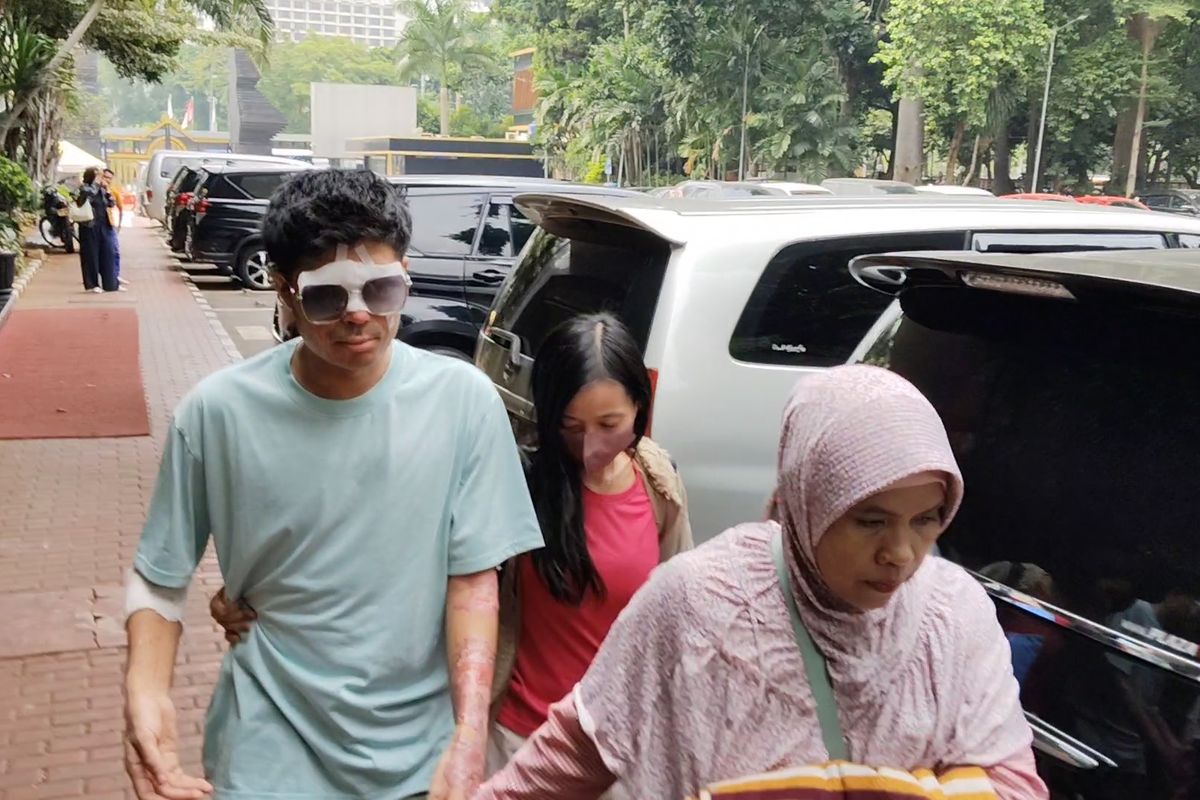 Ditemani Istri dan Wawa, Agus Korban Air Keras Diperiksa di Polda Metro Jaya