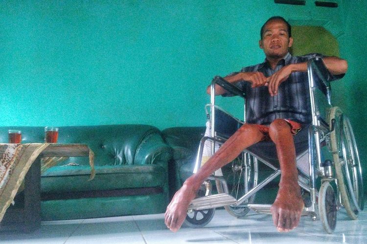 Sahudin (40) mantan penyadap nira di Desa Karangcegak, Kecamatan Kutasari, Purbalingga, Jawa Tengah yang lumpuh karena jatuh dari pohon kelapa.