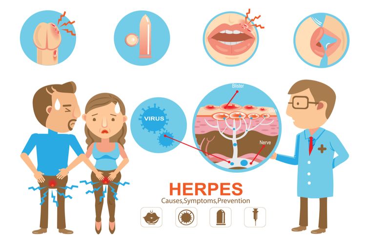 Ilsutrasi herpes genital