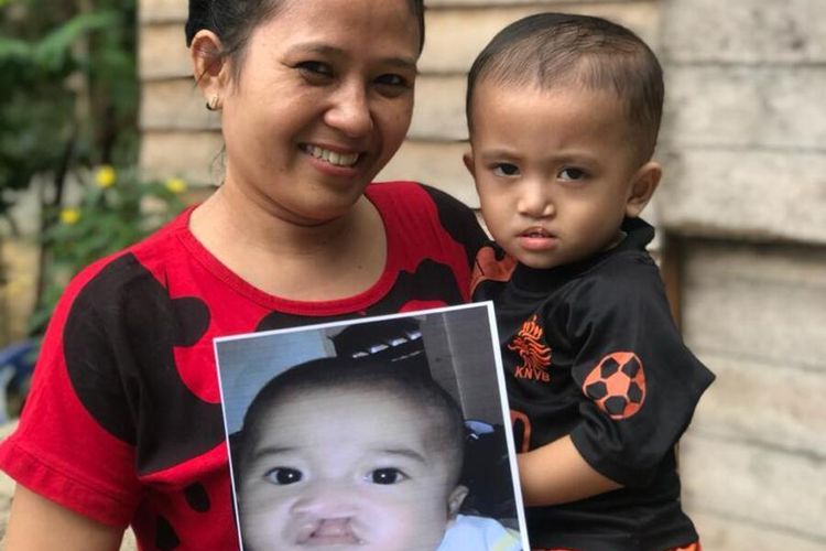 Senyuman pasien Smile Train Indonesia bersama anaknya di pelosok Indonesia