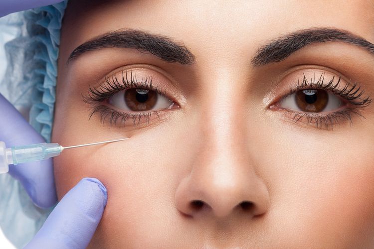 Ilustrasi operasi lipatan mata