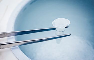 Ilustrasi egg freezing