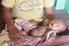 Fatma Bayi Bergizi Buruk Akhirnya Dapat Perawatan Ekstra