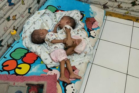 Kisah Rahman dan Rahim, Bayi Kembar Siam di Bekasi yang Menunggu Operasi