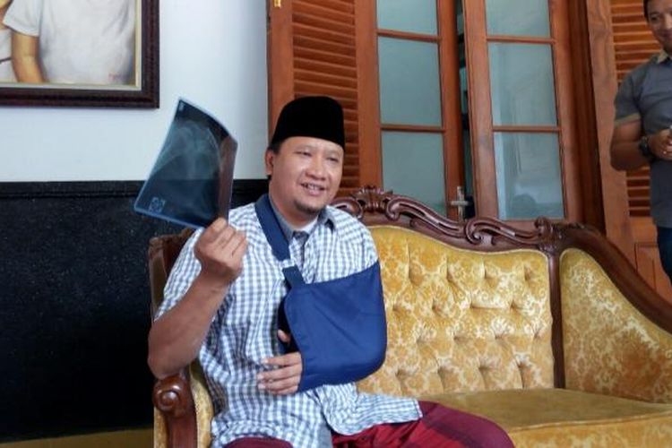 Bupati Pasuruan Irsyad Yusuf masih mengenakan arm sling menunjukkan hasil scan yang menunjukkan patah tulang selangka usai heading di pertandingan sepak bola dalam perayaan HPN bersama wartawan